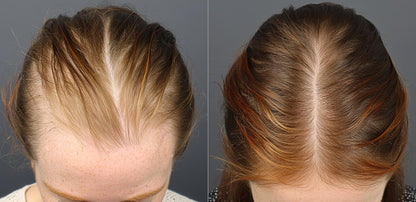 DHT Control | Complexe Anti-Chute