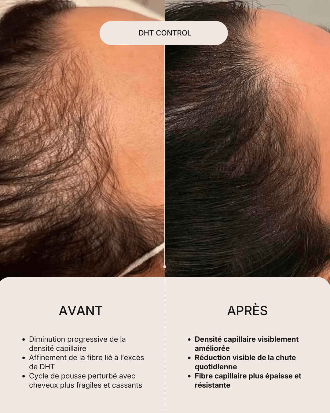 DHT Control | Complexe Anti-Chute