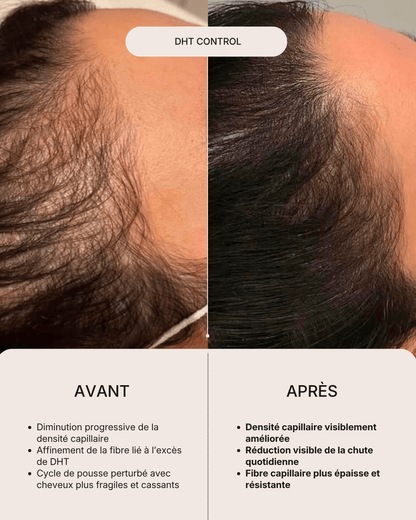 DHT Control | Complexe Anti-Chute