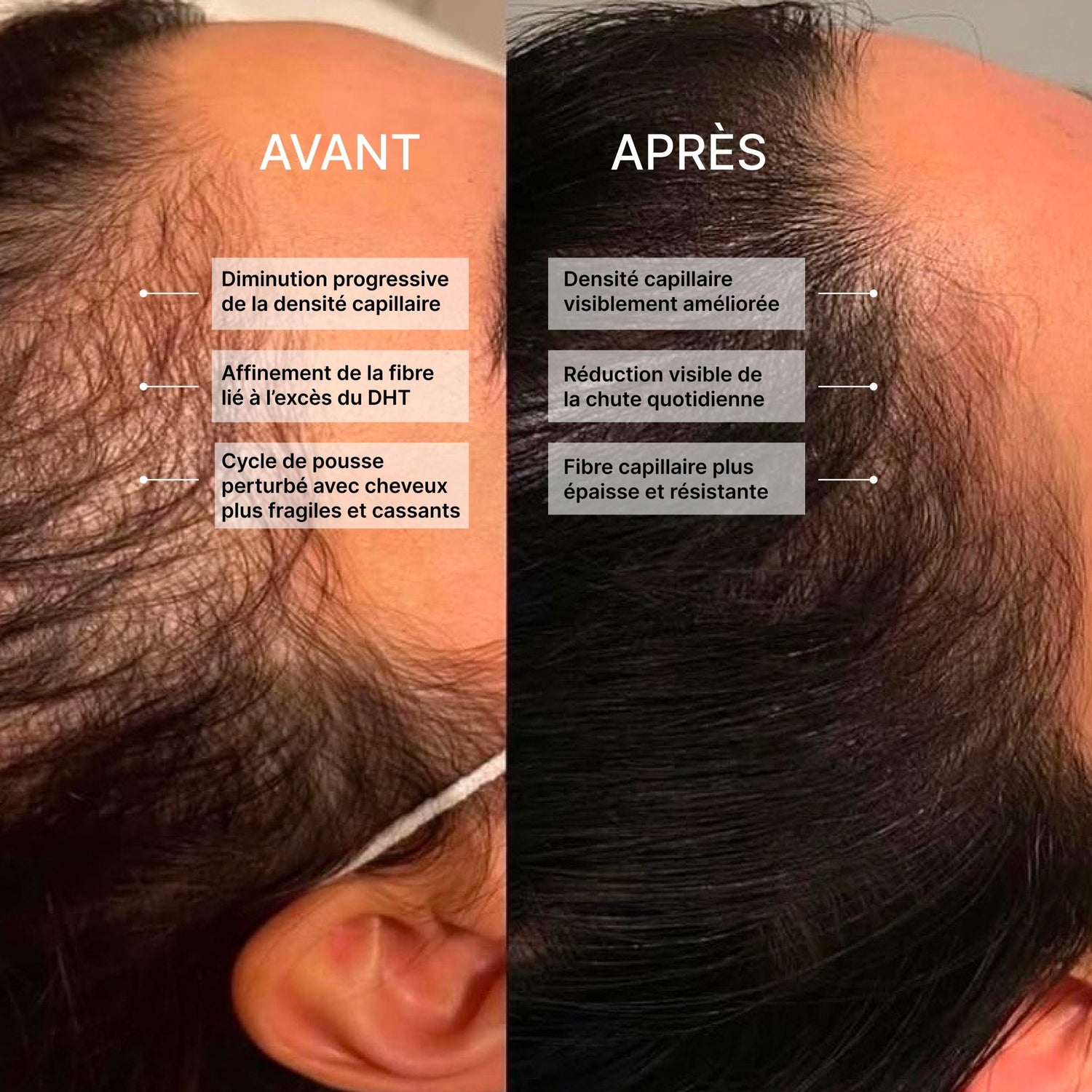 DHT Control | Complexe Anti-Chute