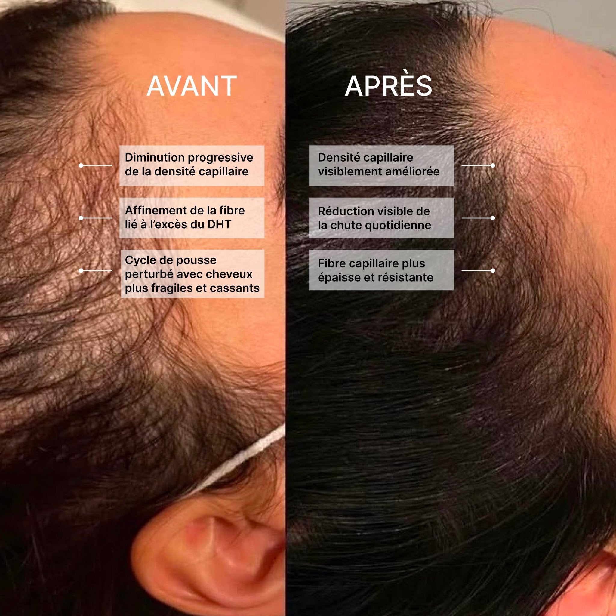 DHT Control | Complexe Anti-Chute