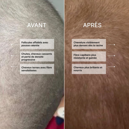 Sérum extrem Pousse