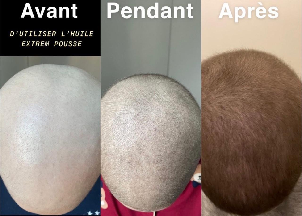 Avant après 90 jours